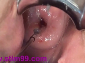 German porn star explores extreme depths in Japanese-style cervix fucking